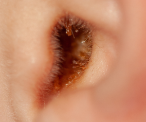 Plymouth Ear Wax Removal Near Me | Plymouth Ear Wax Microsuction | Moor Hearing